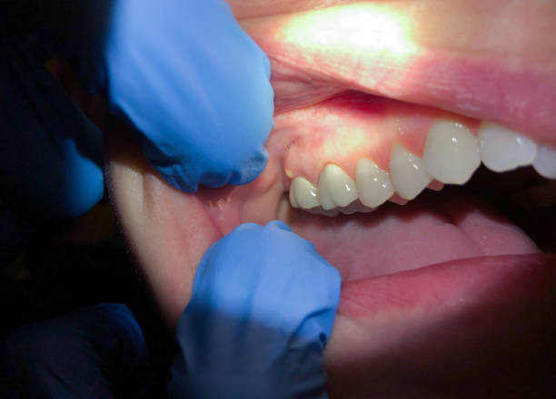 Best Emergency Dentist Near Me  in Bardmoor, FL